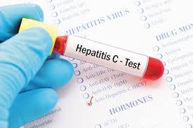 Hepatitis C virus test
