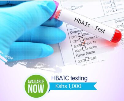 hemoglobin A1c test