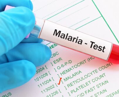 malaria-test